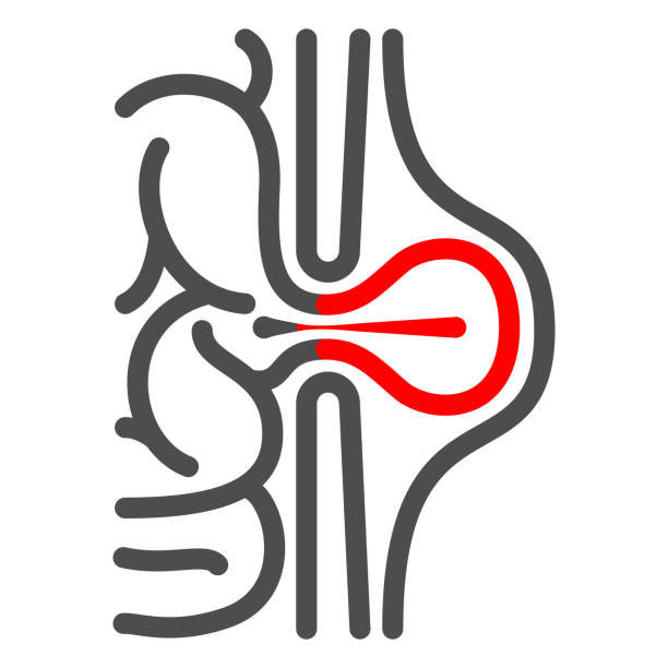 Paediatric Hernia